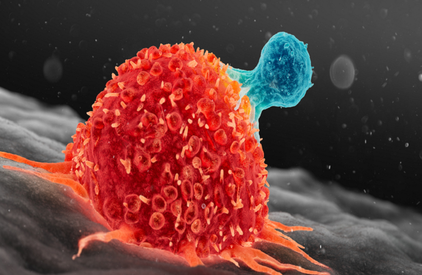 علماء روس يطورون أدوية جديدة لمكافحة الخلايا السرطانية
